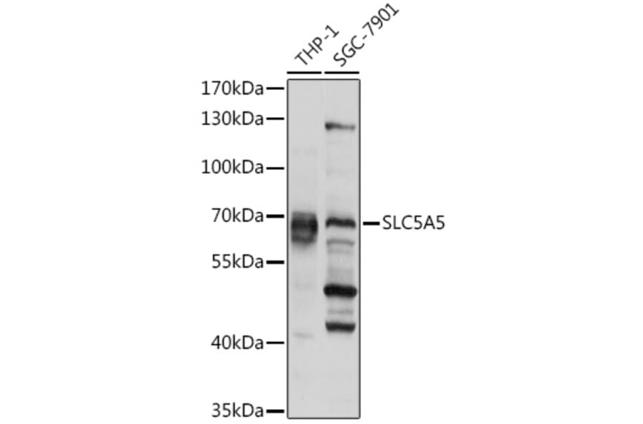 Western Blot - Anti-Sodium Iodide Symporter Antibody (A12380) - Antibodies.com