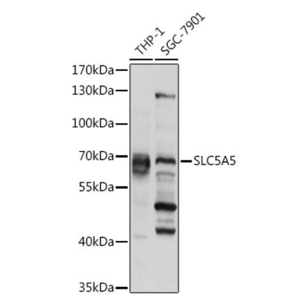 Western Blot - Anti-Sodium Iodide Symporter Antibody (A12380) - Antibodies.com