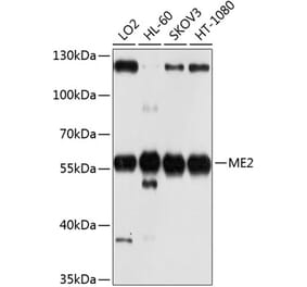 Western Blot - Anti-ME2 Antibody (A12382) - Antibodies.com