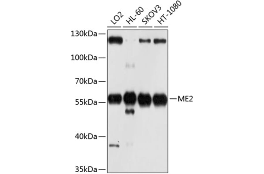 Western Blot - Anti-ME2 Antibody (A12382) - Antibodies.com