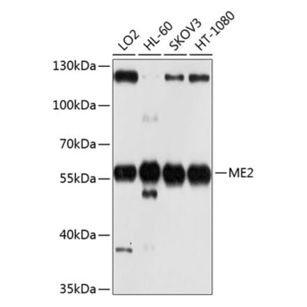 Western Blot - Anti-ME2 Antibody (A12382) - Antibodies.com