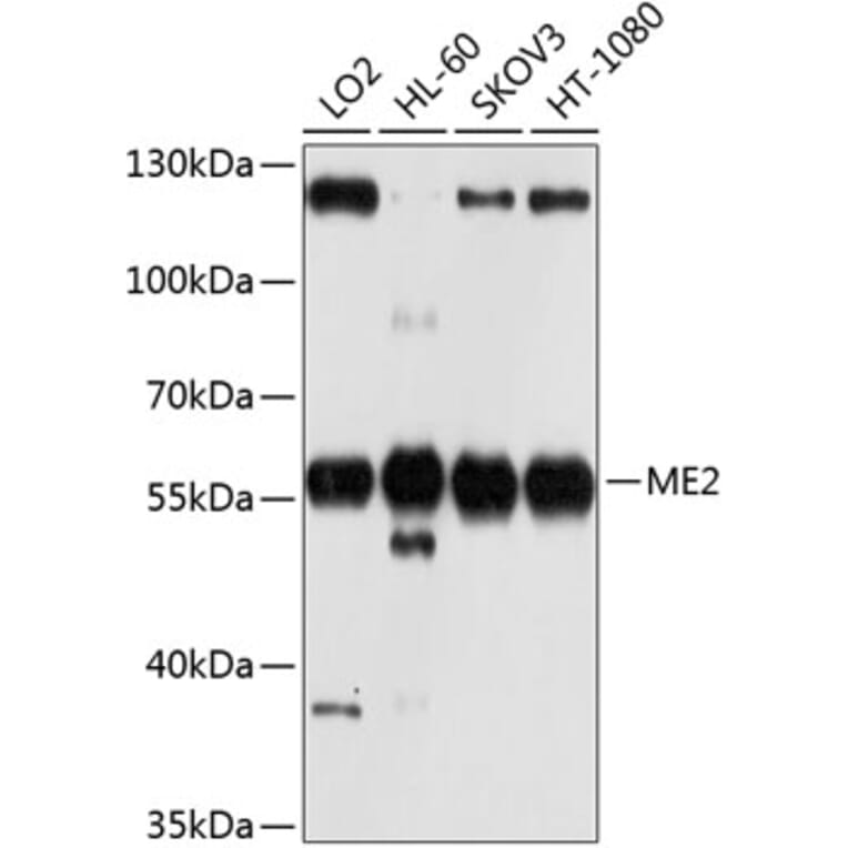 Western Blot - Anti-ME2 Antibody (A12382) - Antibodies.com