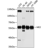 Western Blot - Anti-ME2 Antibody (A12382) - Antibodies.com