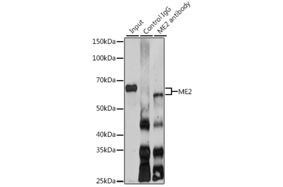 Western Blot - Anti-ME2 Antibody (A12382) - Antibodies.com