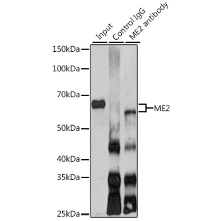 Western Blot - Anti-ME2 Antibody (A12382) - Antibodies.com