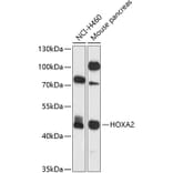 Western Blot - Anti-HOXA2 Antibody (A12384) - Antibodies.com