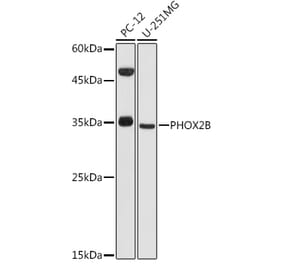 Western Blot - Anti-PHOX2B Antibody (A12386) - Antibodies.com