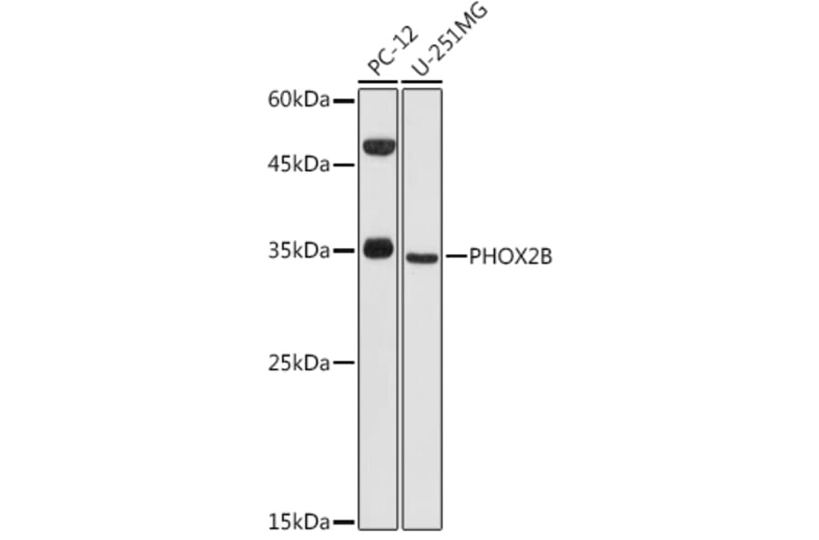 Western Blot - Anti-PHOX2B Antibody (A12386) - Antibodies.com