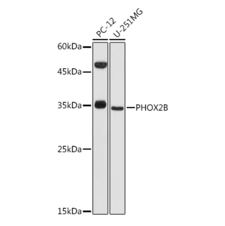 Western Blot - Anti-PHOX2B Antibody (A12386) - Antibodies.com