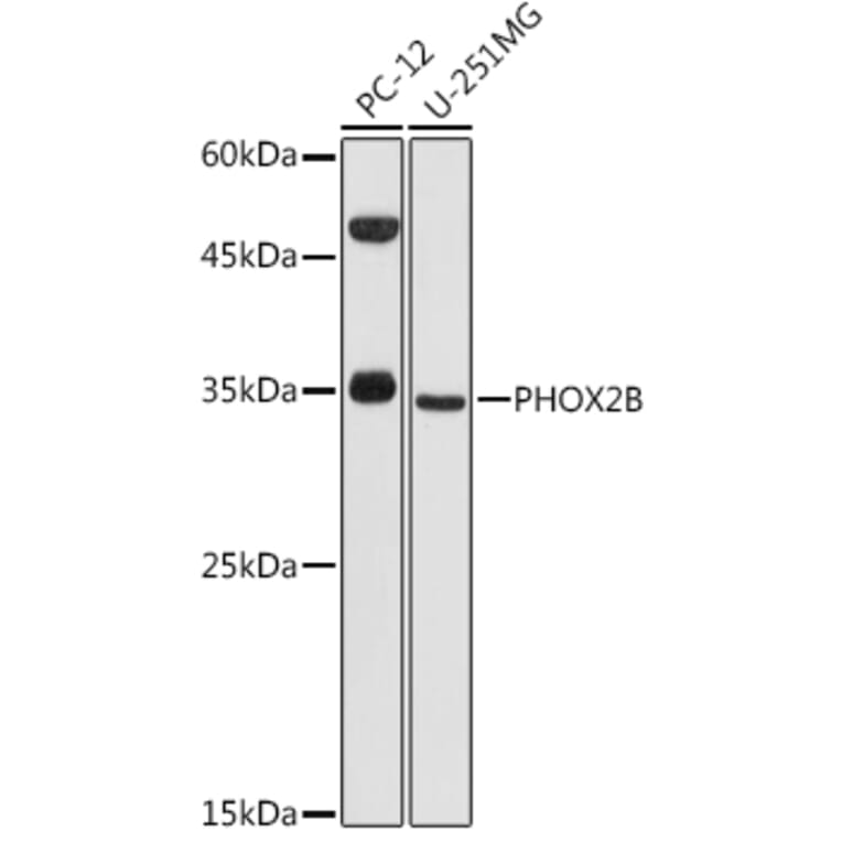 Western Blot - Anti-PHOX2B Antibody (A12386) - Antibodies.com