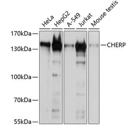 Western Blot - Anti-CHERP Antibody (A9702) - Antibodies.com