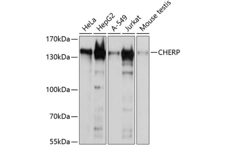 Western Blot - Anti-CHERP Antibody (A9702) - Antibodies.com