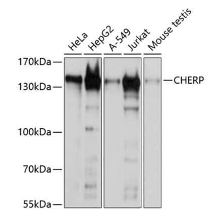 Western Blot - Anti-CHERP Antibody (A9702) - Antibodies.com