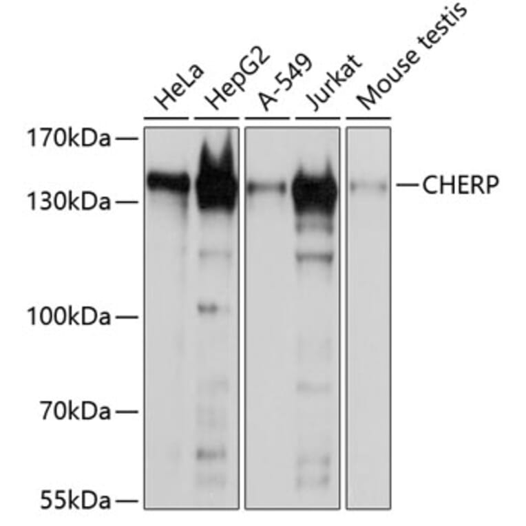 Western Blot - Anti-CHERP Antibody (A9702) - Antibodies.com