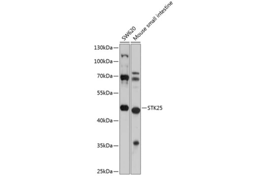 Western Blot - Anti-STK25 Antibody (A12390) - Antibodies.com