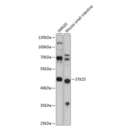 Western Blot - Anti-STK25 Antibody (A12390) - Antibodies.com