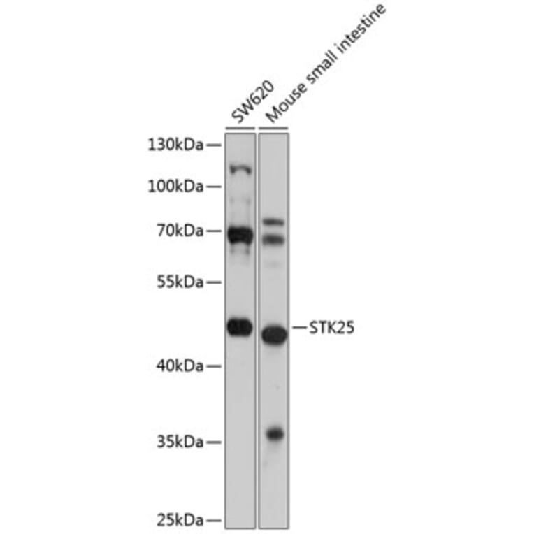 Western Blot - Anti-STK25 Antibody (A12390) - Antibodies.com