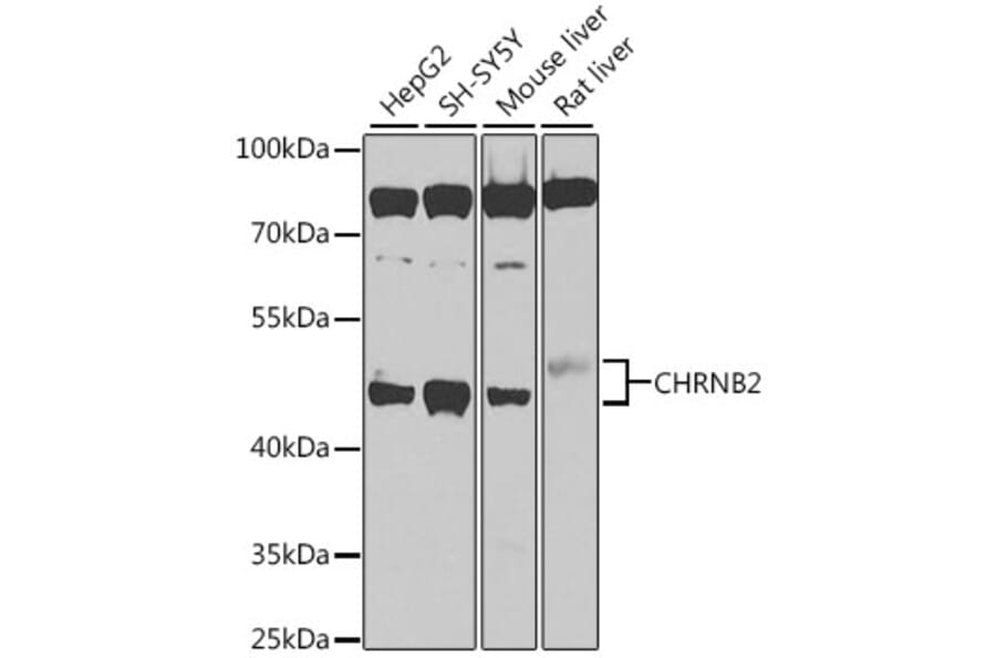 Western Blot - Anti-Nicotinic Acetylcholine Receptor beta 2/CHRNB2 Antibody (A12396) - Antibodies.com