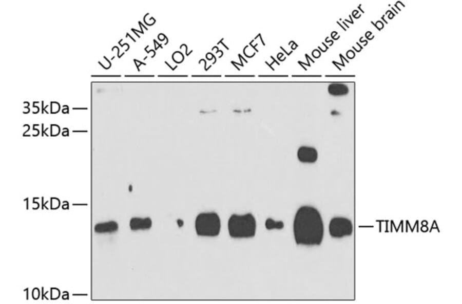 Western Blot - Anti-TIMM8A/DDP Antibody (A12397) - Antibodies.com