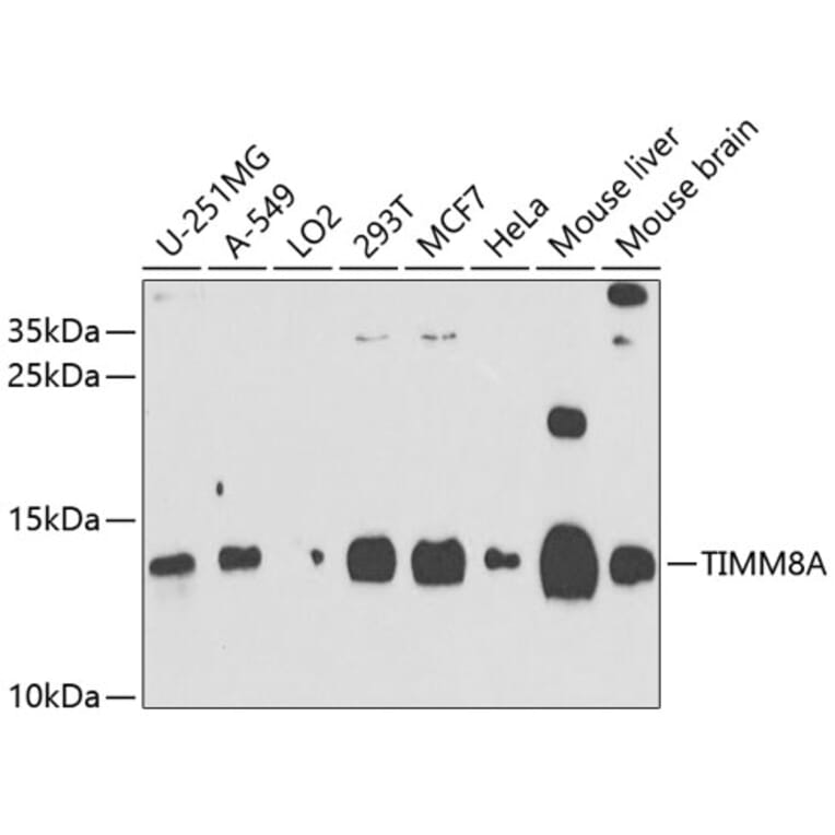 Western Blot - Anti-TIMM8A/DDP Antibody (A12397) - Antibodies.com