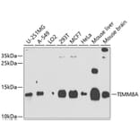 Western Blot - Anti-TIMM8A/DDP Antibody (A12397) - Antibodies.com
