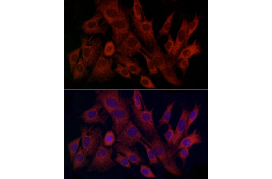 Immunofluorescence - Anti-TIMM8A/DDP Antibody (A12397) - Antibodies.com