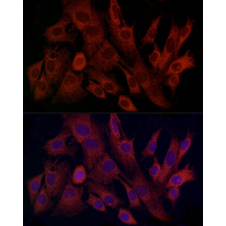 Immunofluorescence - Anti-TIMM8A/DDP Antibody (A12397) - Antibodies.com