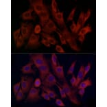 Immunofluorescence - Anti-TIMM8A/DDP Antibody (A12397) - Antibodies.com
