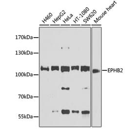 Western Blot - Anti-Eph receptor B2 Antibody (A12398) - Antibodies.com