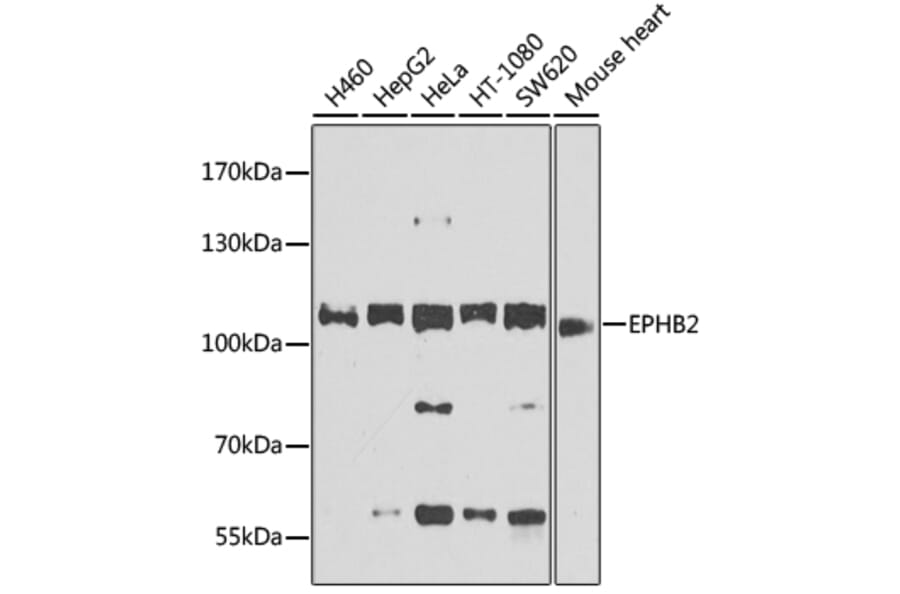 Western Blot - Anti-Eph receptor B2 Antibody (A12398) - Antibodies.com