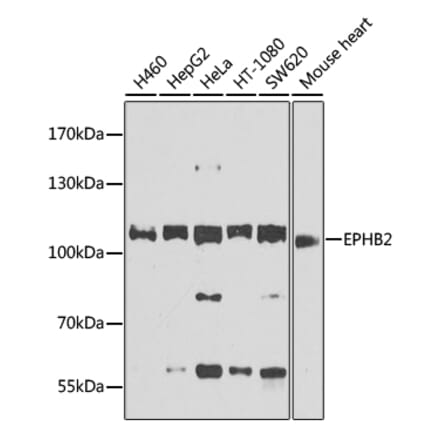 Western Blot - Anti-Eph receptor B2 Antibody (A12398) - Antibodies.com