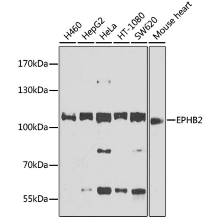 Western Blot - Anti-Eph receptor B2 Antibody (A12398) - Antibodies.com