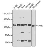 Western Blot - Anti-Eph receptor B2 Antibody (A12398) - Antibodies.com