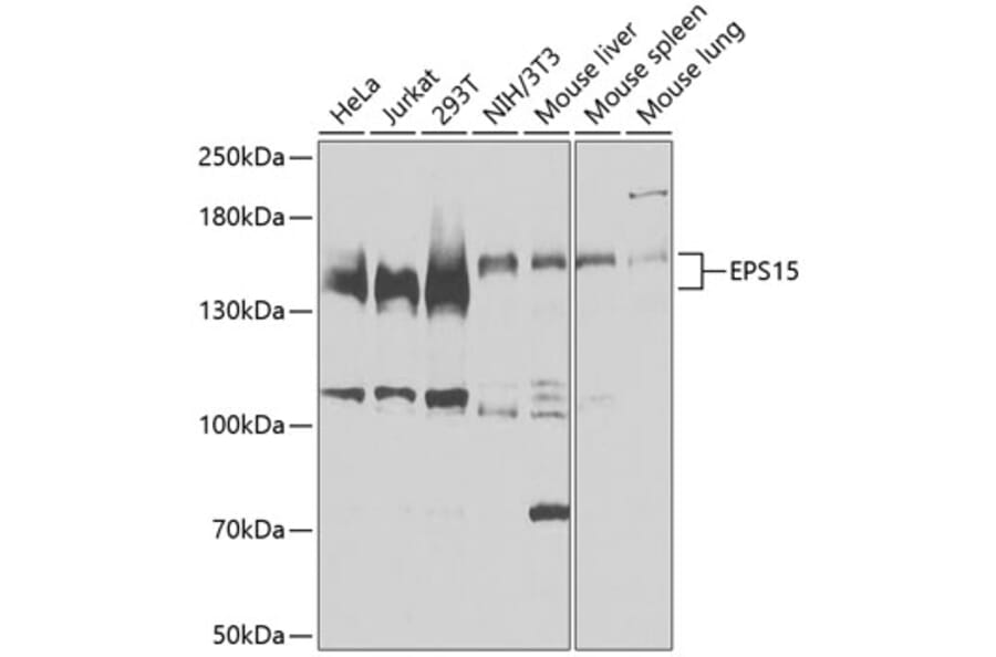 Western Blot - Anti-EPS15 Antibody (A9814) - Antibodies.com