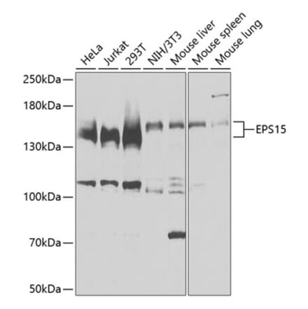 Western Blot - Anti-EPS15 Antibody (A9814) - Antibodies.com