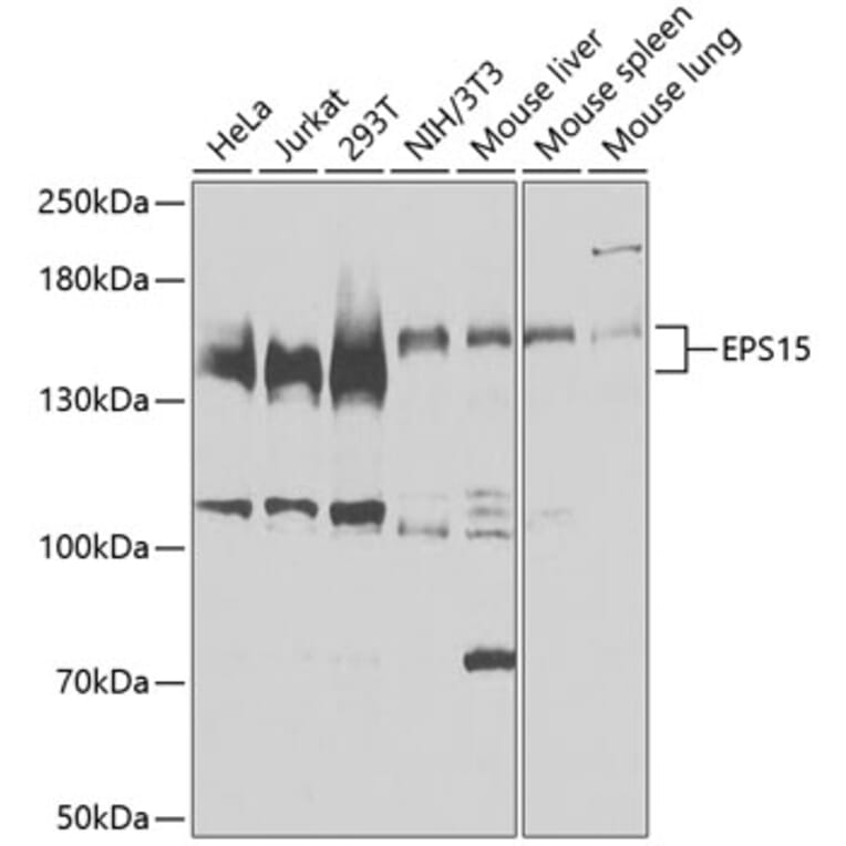 Western Blot - Anti-EPS15 Antibody (A9814) - Antibodies.com