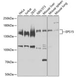 Western Blot - Anti-EPS15 Antibody (A9814) - Antibodies.com