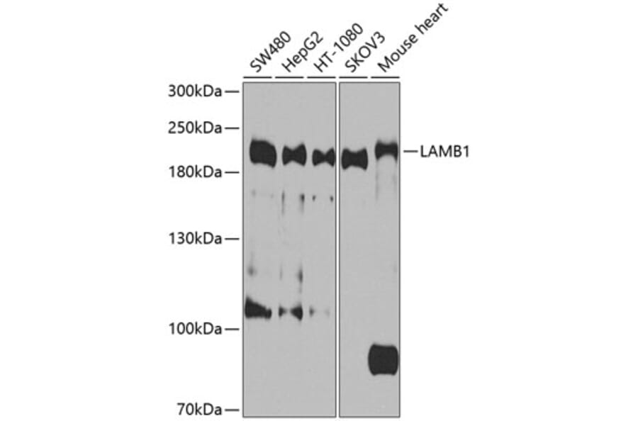 Western Blot - Anti-LAMB1 Antibody (A9827) - Antibodies.com