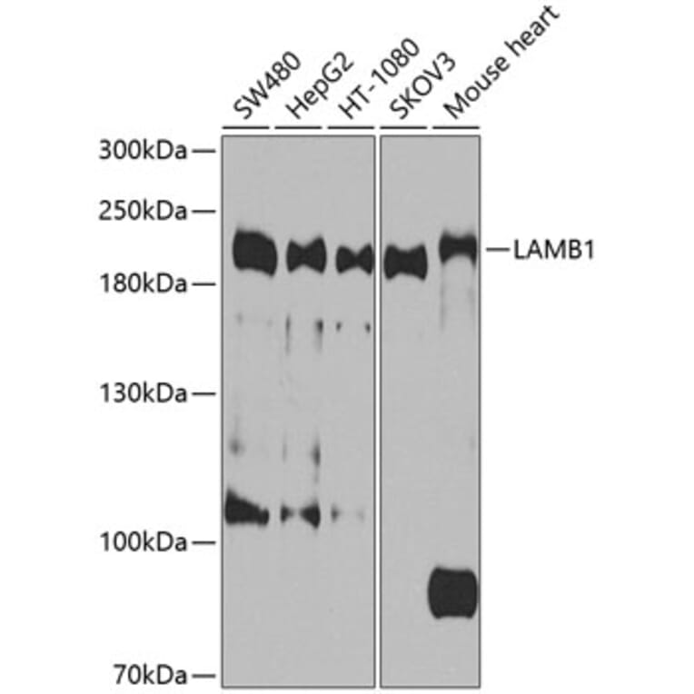 Western Blot - Anti-LAMB1 Antibody (A9827) - Antibodies.com