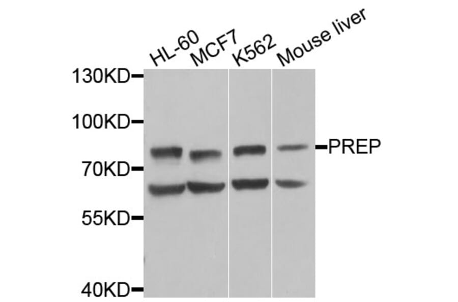 Western Blot - Anti-PREP Antibody (A9838) - Antibodies.com