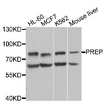 Western Blot - Anti-PREP Antibody (A9838) - Antibodies.com