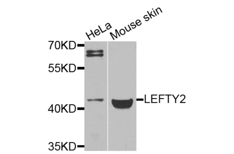 Western Blot - Anti-LEFTY2 Antibody (A9846) - Antibodies.com