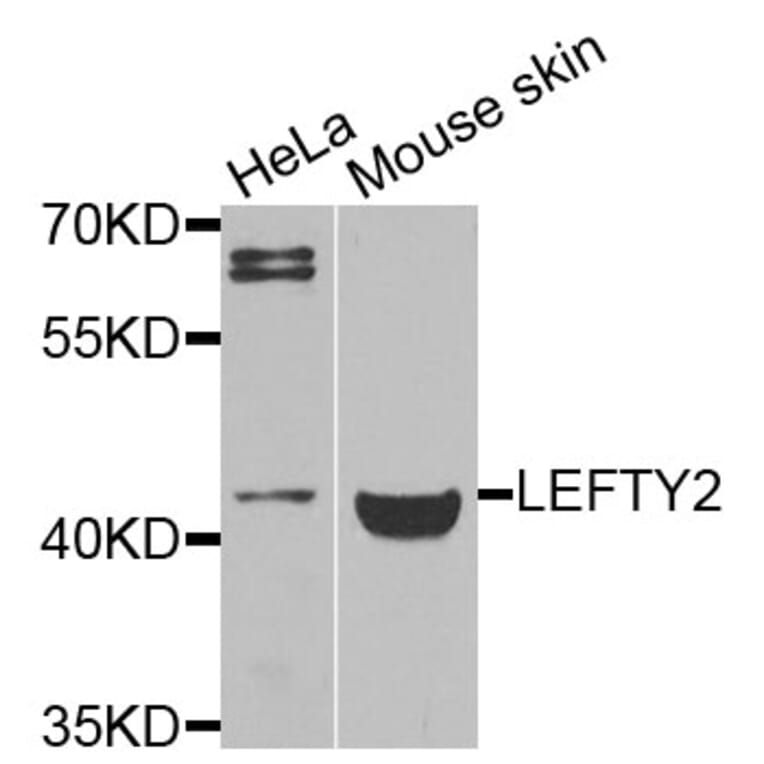 Western Blot - Anti-LEFTY2 Antibody (A9846) - Antibodies.com