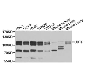 Western Blot - Anti-UBTF Antibody (A9847) - Antibodies.com