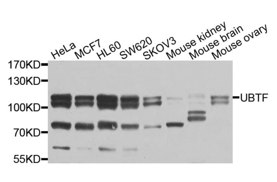 Western Blot - Anti-UBTF Antibody (A9847) - Antibodies.com