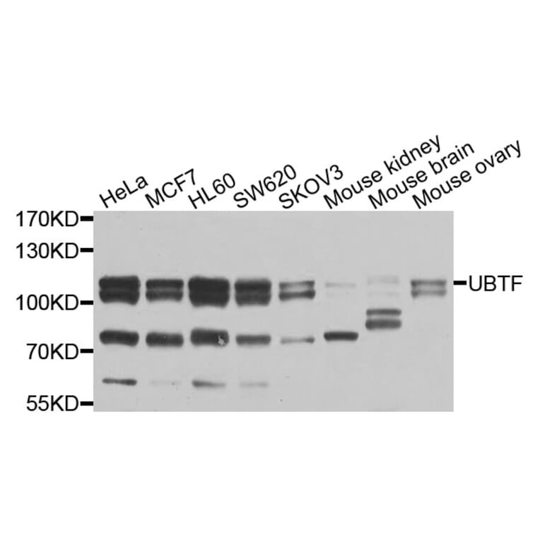 Western Blot - Anti-UBTF Antibody (A9847) - Antibodies.com