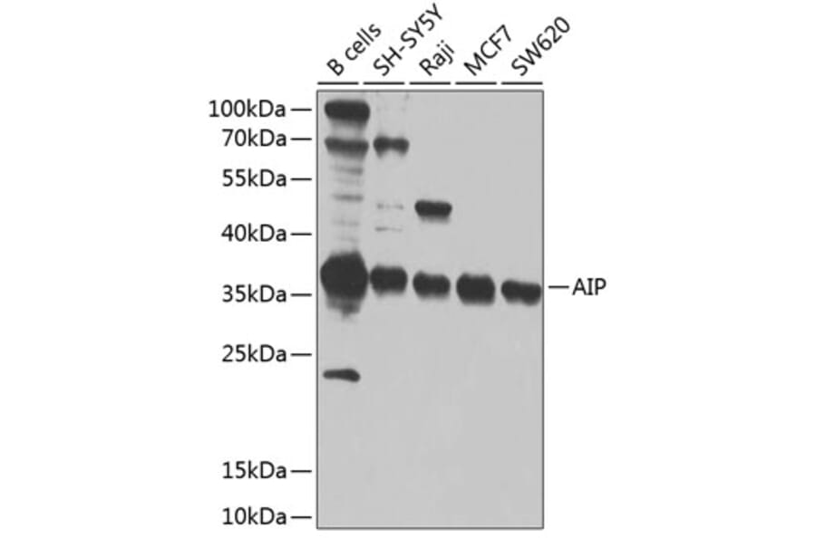 Western Blot - Anti-AIP Antibody (A12404) - Antibodies.com