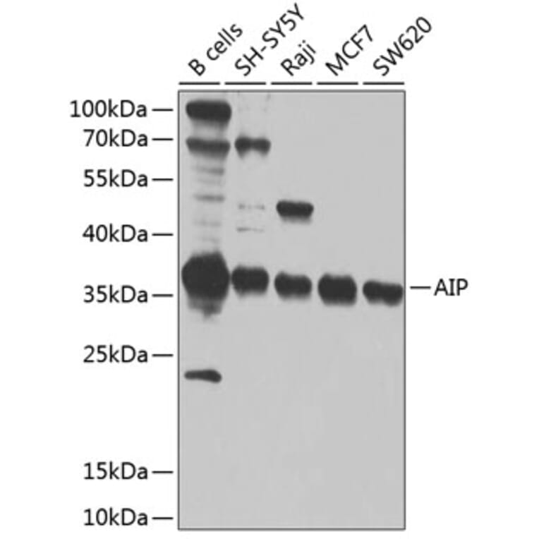 Western Blot - Anti-AIP Antibody (A12404) - Antibodies.com
