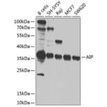 Western Blot - Anti-AIP Antibody (A12404) - Antibodies.com