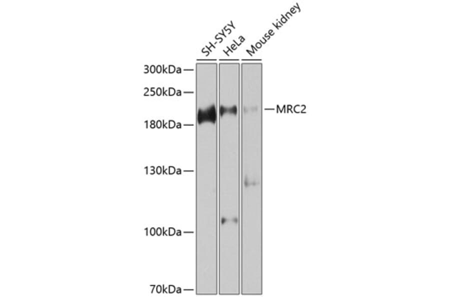 Western Blot - Anti-MRC2/ENDO180 Antibody (A12405) - Antibodies.com